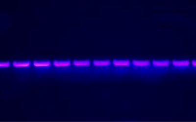 Cómo Interpretar Resultados de Electroforesis en Gel de ADN