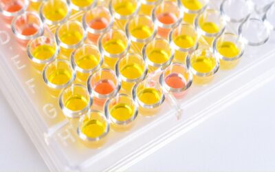 Detection Assays for Proteins:  Chromogenic vs Chemiluminescent vs Fluorometric