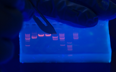 How to Interpret DNA Gel Electrophoresis Results