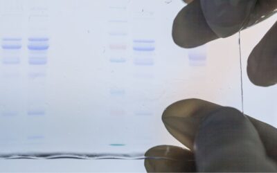 Protein Electrophoresis Using SDS-PAGE: A Detailed Overview